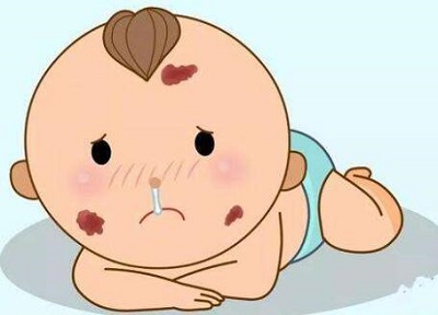 婴儿怎么会有胎记？南京治疗胎记的专科医院怎么样？